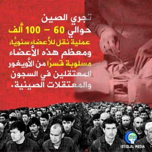 عميات نقل الأعضاء