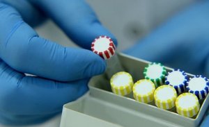 ÇİN’İN HİNDİSTAN’A SATTIĞI TEST KİTLERİNDE SORUN YAŞANDI